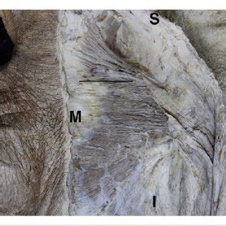 Human muscle system, the muscles of the. Both trapezius muscles have been cut medially and reflected laterally.... | Download Scientific ...