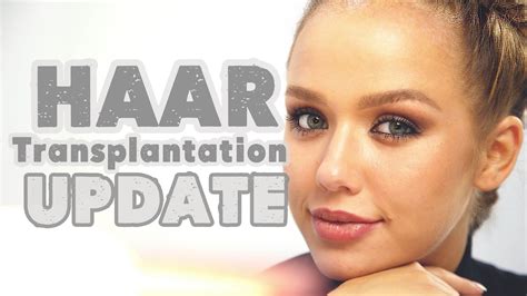 Bei facebook präsentierte sie sich mit natürlichem look. Daniela Katzenberger Augenbrauen Transplantation - Cemburubuta