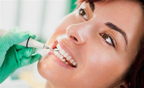 ¿en Qué Consiste Una Limpieza Dental Con Ultrasonidos