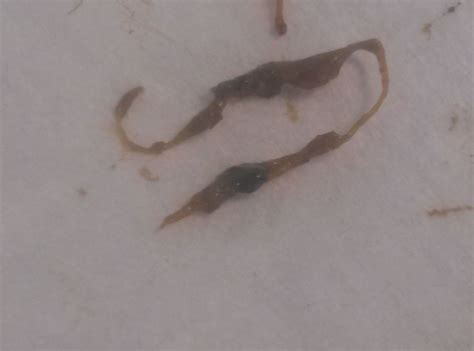 I uploaded a new vid to my you tube channel for the garden tower people. Found what looks like worms in my stool. Please help ...