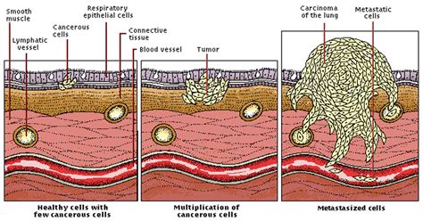 Cancer cells differ from normal cells in the body in many ways. Olive Oil Kills Cancer Cells In 30 Minutes. Here's How ...