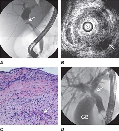 Video Atlas Of Gastrointestinal Endoscopy Basicmedical Key