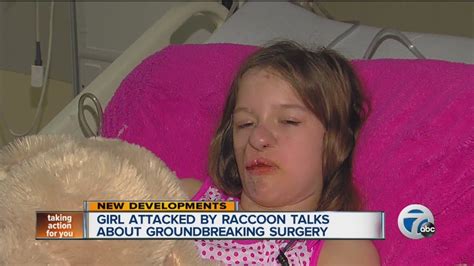 girl attacked by raccoon talks about groundbreaking surgery youtube