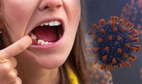 Covid Symptoms New Long Covid Sign May Be Gum Disease Say Dentists