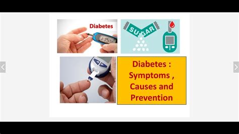 Diabetes Symptoms Causes Prevention Treatment Who Medical Youtube