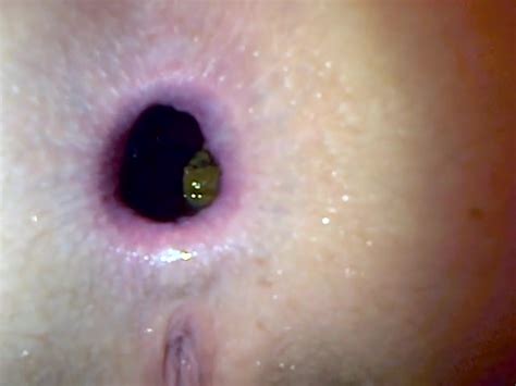Inside Woman Ass Hole