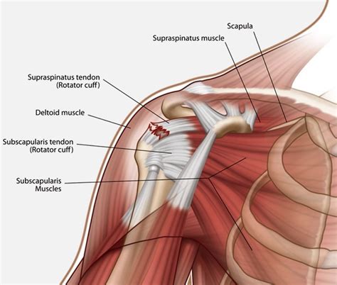 Rotator Cuff Tendon Injury Diagnosis Treatment And Recovery