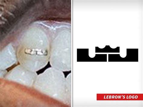 Lebron James Gets Lj Logo Imprinted On Tooth