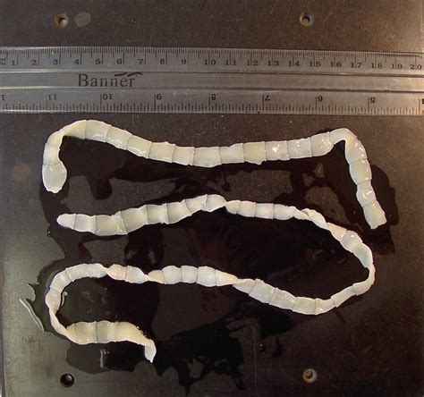 Tapeworm Proglottids Tapeworm Segments Vomited By Pregnant Flickr