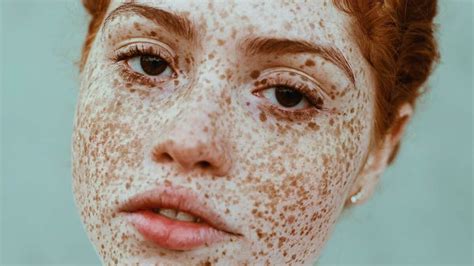 4 Words Describing Freckles Youve Never Heard Before
