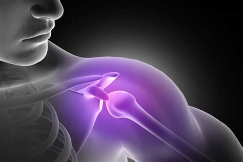 Shoulder Pain Arthritis And Rheumatology Clinical Center Of Northern