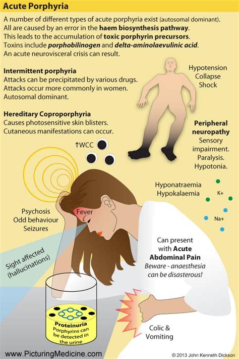 Porphyria Attack Symptoms