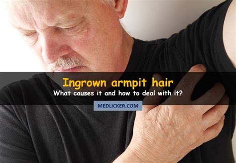 Since ingrown hairs cause skin irritation, they tend to look like raised bumps under arms. Ingrown Underarm Hair - Treatment, Prevention & More