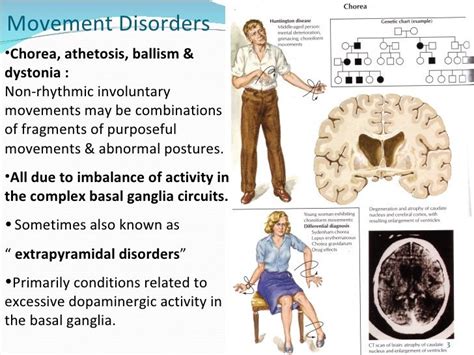 Movement Disorders Lecture Nursing Information Disorders Neurological Disorders