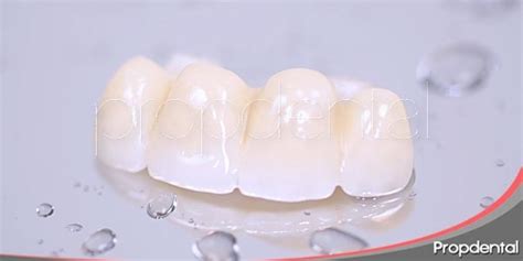 Envío Peatonal Redondear a la baja tipos de puentes dentales vendedor