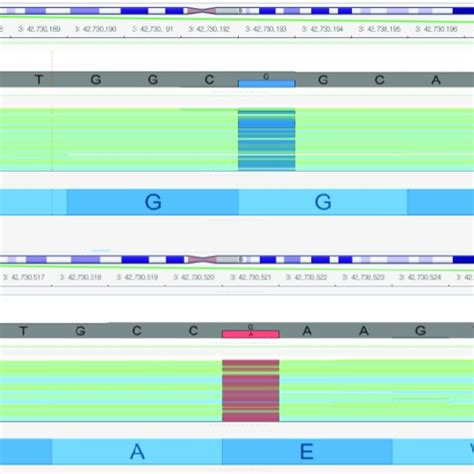 Next Generation Sequencing Analysis Showing Compound Heterozygous Download Scientific Diagram