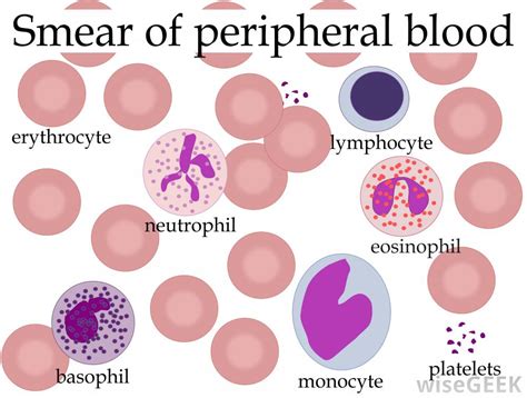 Differential count on the peripheral blood smears with their concentration. What is a Differential White Cell Count? (with pictures)