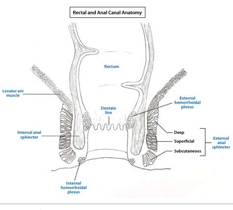 Perianal Fistulas In Patients With Crohn S Disease Part 1 Current