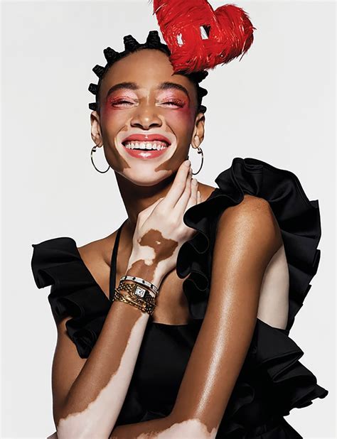 Winnie Harlow Pictures Hotness Rating Unrated