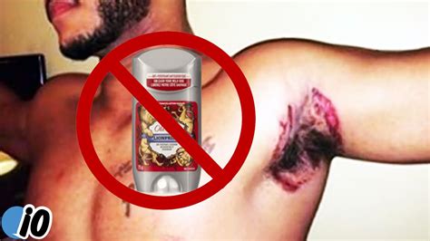 Old Spice Deodorant Is Leaving People With Bad Burns Youtube