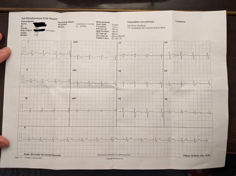 Can Someone Help Me Understand My Ecg Please R Medical Advice