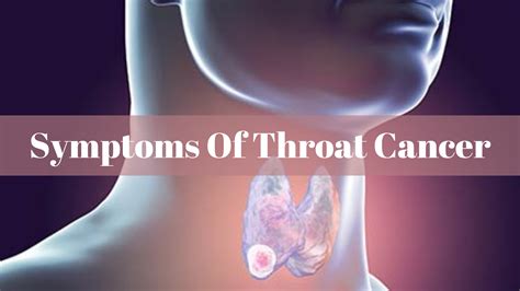 Best Hospital For Throat Cancer In India Candrol Centre Of Oncology