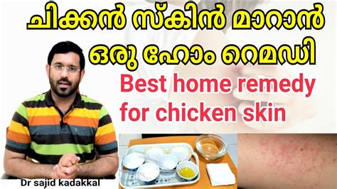 Best Home Remedy For Chicken Skin Keratosis Pilaris ചിക്കൻ സ്കിൻ മാറാ