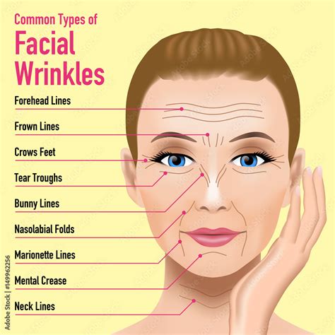 Common Types Of Facial Wrinkles Cosmetic Surgery Woman Facial