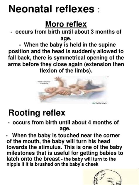 Neonatal Reflexes Pdf