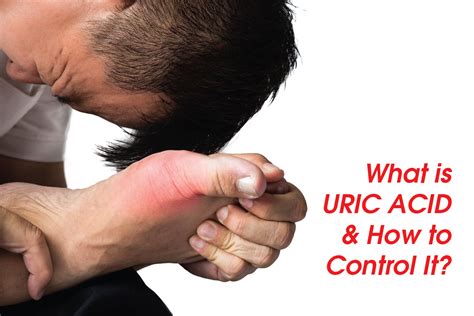 What Causes High Uric Acid And How To Control It
