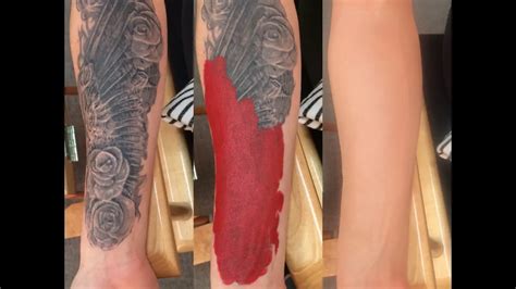 How To Cover Up A Tattoo Vegan Tattoo Studios