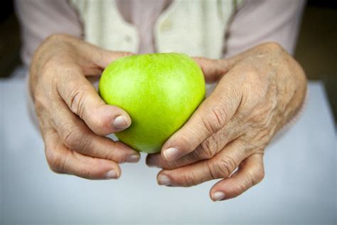 Artritis Reumatoide Manos Y Frutas Apple A Disposici N Flickr