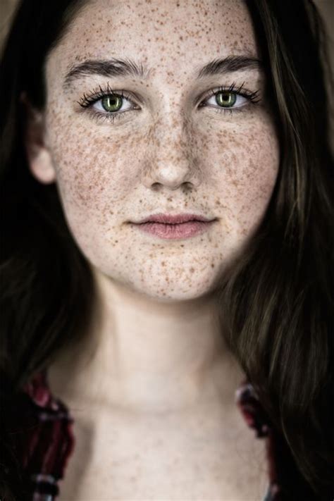 Stunning Portraits That Show Just How Beautiful Freckles Are Red