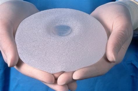 Reports Of Breast Implant Illnesses Prompt Federal Review The New York Times