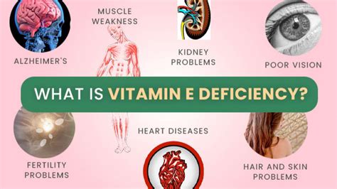 What Is Vitamin E Deficiency Causes Symptoms Complications Diagnosis And Treatments