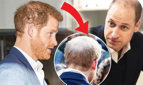 Prince william, duke of cambridge. Why are Prince Harry and William going bald? What can you ...