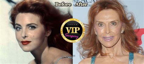 Tina Louise Plastic Surgery Surgery Vip