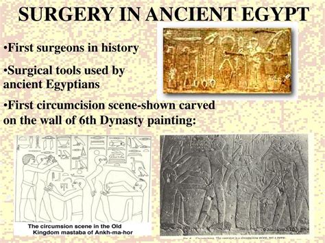 Ppt Medicine In Ancient Egypt Powerpoint Presentation Free Download Id 3318674