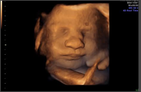 30 Weeks Pregnant Ultrasound