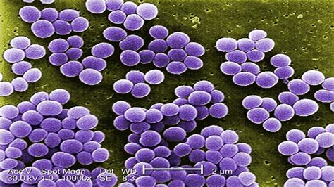 Increasing Susceptibility Of Staphylococcus Aureus In The Us