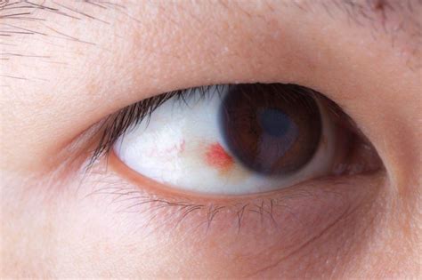 42 Strange Symptoms That Can Signal A Serious Disease Ojos Ojos