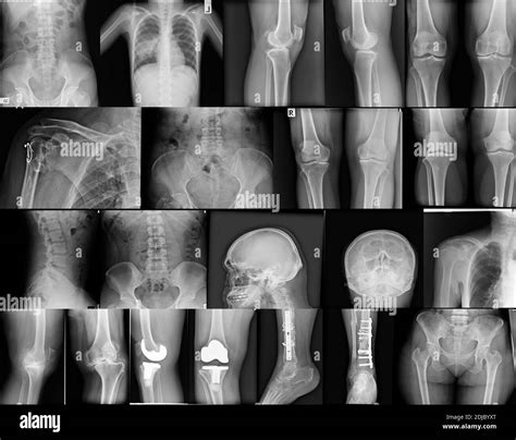 Full Body X Ray Hi Res Stock Photography And Images Alamy