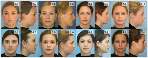 The results will be given. Association of Frontal and Lateral Facial Attractiveness ...