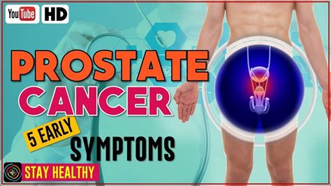 Some men need to urinate often, especially at night. 5 Early Signs of Prostate Cancer You Should Know - YouTube