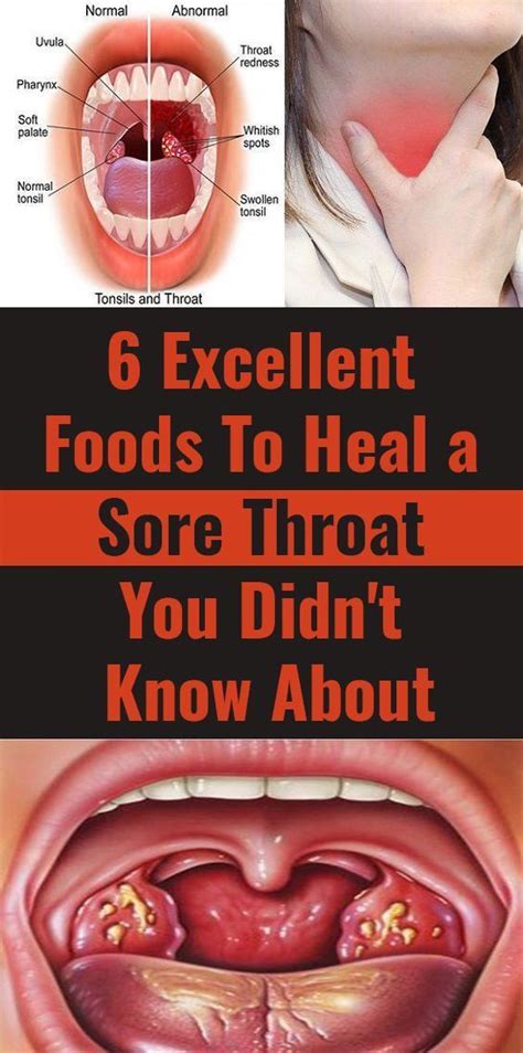 6 Foods That Can Help You Heal Sore Throat In 2021 Heal Sore Throat