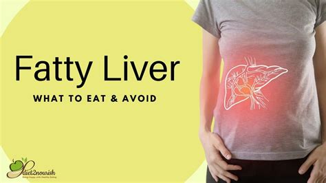 Fatty Liver Treatment Diet Chart Foods To Eat And Lose That Fatty Liver