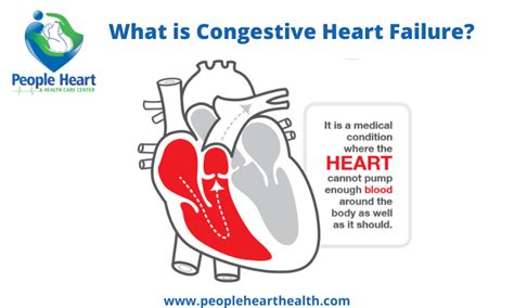 What Is Congestive Heart Failure Or Chf Symptoms And Causes
