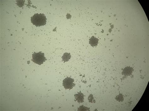 Microscopie Des Colonies De Candida Albicans Image Stock Image Du