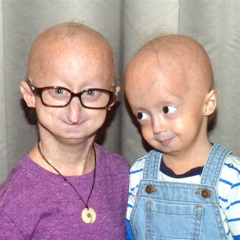 The Progeria Research Foundation For The Children ♥ For The Cure