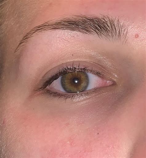 Been told I have central heterochromia, but also been told 